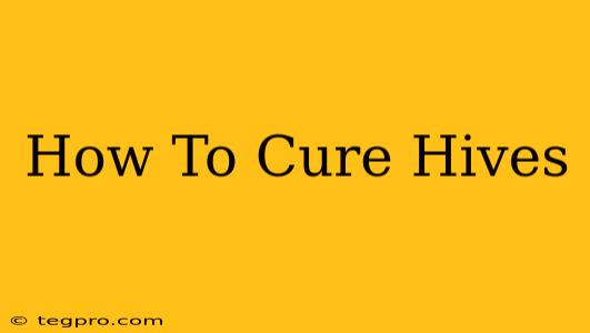 How To Cure Hives