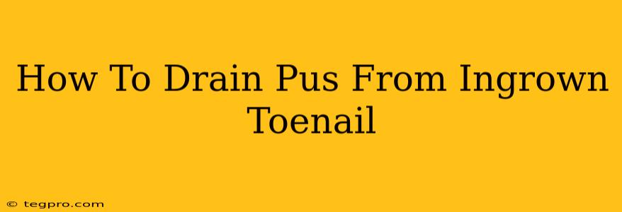 How To Drain Pus From Ingrown Toenail