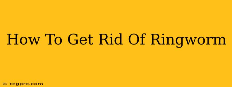 How To Get Rid Of Ringworm