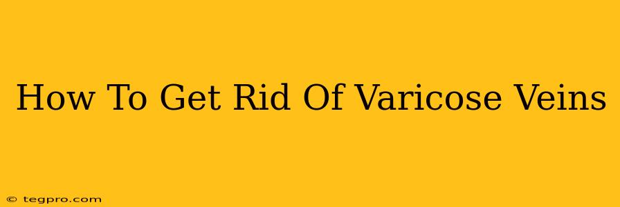 How To Get Rid Of Varicose Veins