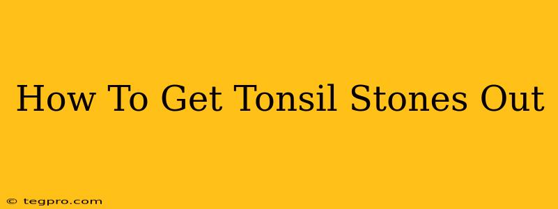 How To Get Tonsil Stones Out