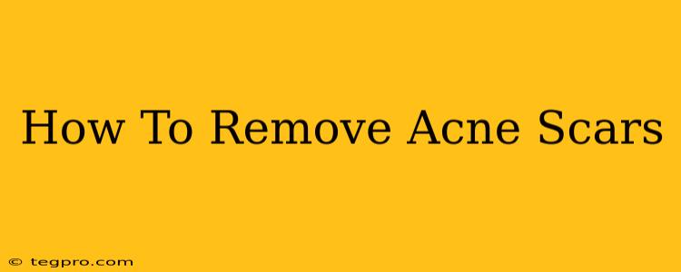 How To Remove Acne Scars