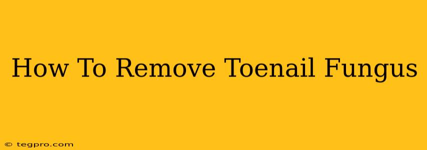 How To Remove Toenail Fungus